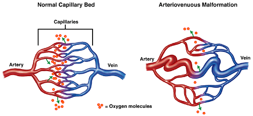 Die Angstneurose. Mit zwei Analysen nach